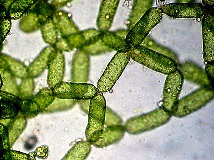 Mga kolonya ng unicellular algae sa ilalim ng isang mikroskopyo